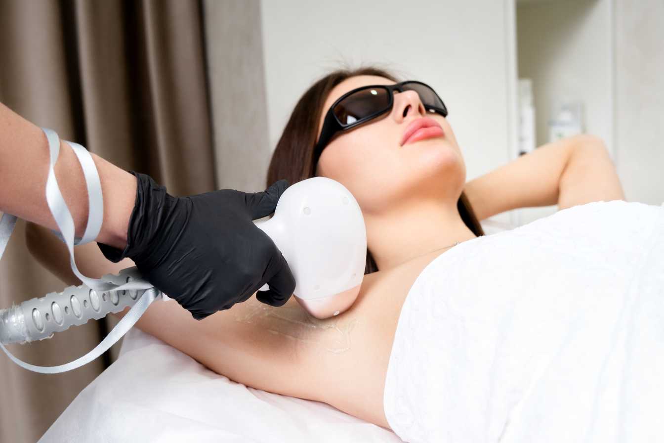 ipl laser 1